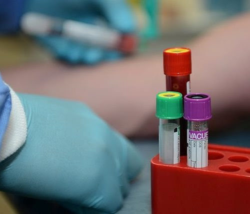 Virus Versus Virus: ‘ReScan’ Antibody Test is a Powerful New Tool