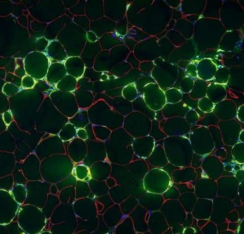 Blood vessel cells implicated in chronic inflammation of obesity