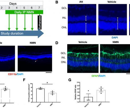 Aging-US: Nicotinamide mononucleotide in degenerative model of retinal detachment