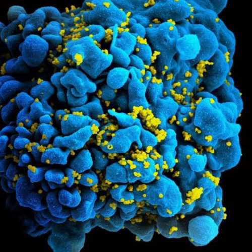 Antibody infusions prevent acquisition of some HIV strains, NIH studies find