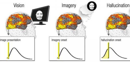 A brain mechanism underlying ‘vision’ in the blind is revealed