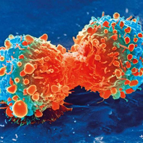 An unexpected, and novel, target for prostate cancer—our biological clock