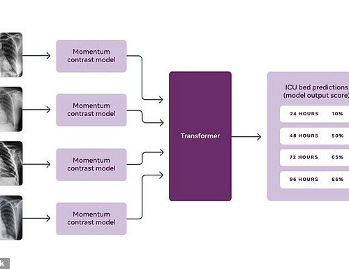 Facebook claims its AI can predict four days in advance if a coronavirus patient’s condition will deteriorate