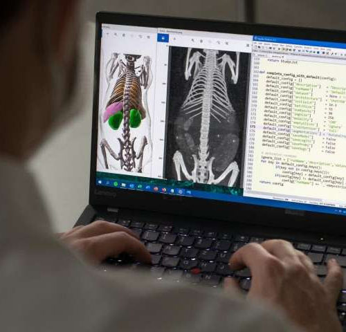 Self-learning algorithms analyze medical imaging data