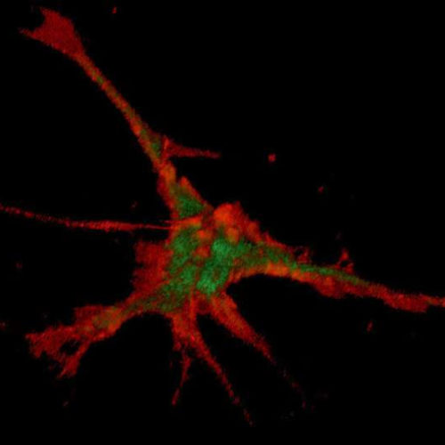 Parkinson’s: Initial steps to show nerves their growth direction magnetically