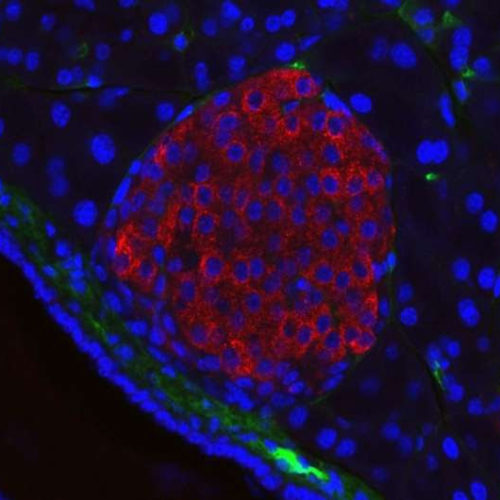 Researchers identify novel target that could improve the safety of CAR T cell therapy for pancreatic cancer