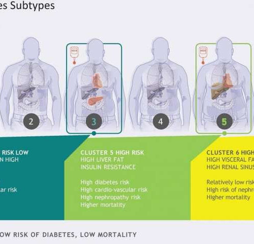 Prediabetes subtypes identified