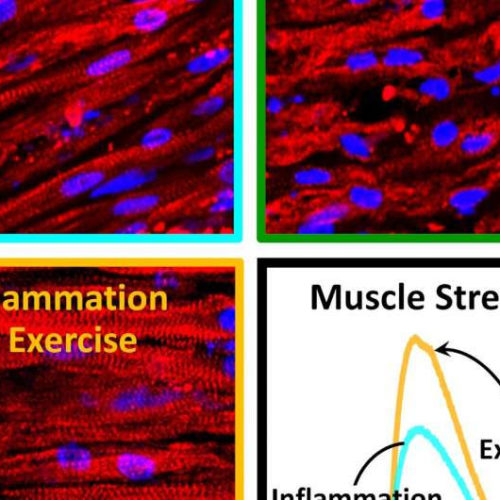 Exercising muscle combats chronic inflammation on its own