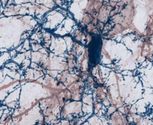 Inflammatory reactions in multiple sclerosis lead to synapse loss in the cerebral cortex