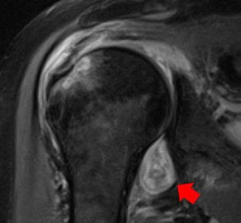 Radiological images confirm ‘COVID-19 can cause the body to attack itself’