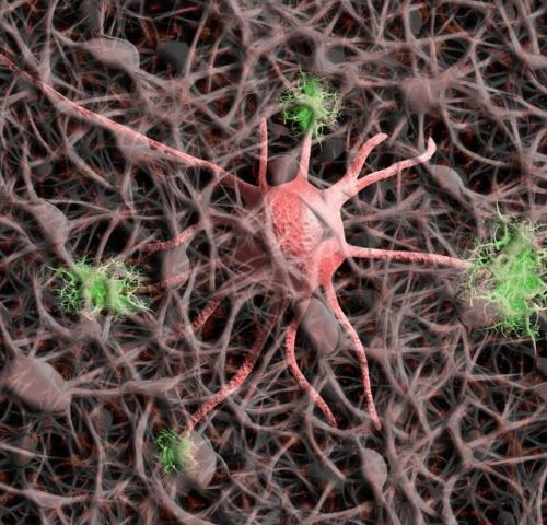 USask-led research team shows alternate form of brain protein that causes Alzheimer’s actually protects against the disease