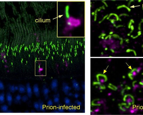 Scientists identify locations of early prion protein deposition in retina