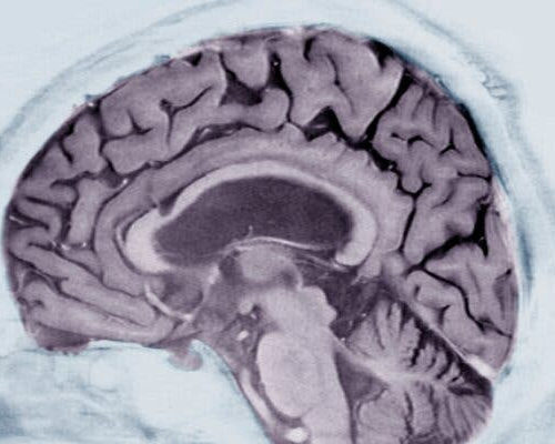 Alzheimer’s Prediction May Be Found in Writing Tests