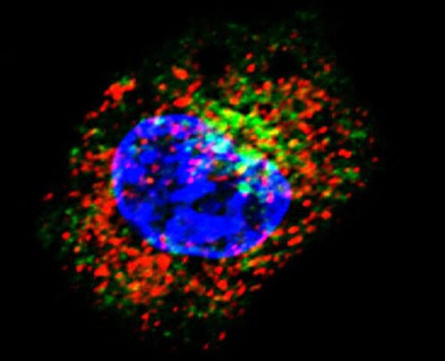 How a Little-Known Glycoprotein Blocks a Cancer Cell’s Immune Response