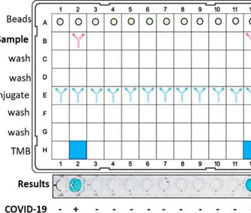 New rapid test to detect coronavirus antibodies developed