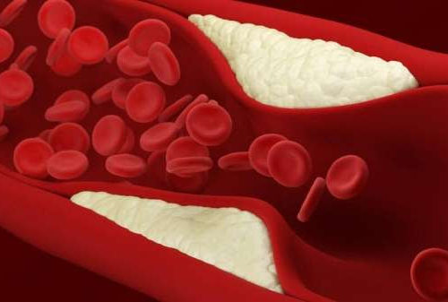 Synthetic ‘mini’ receptors block atherosclerosis