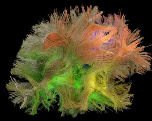 Newly discovered brain pattern has implications for treating paralyzed, Parkinson’s patients