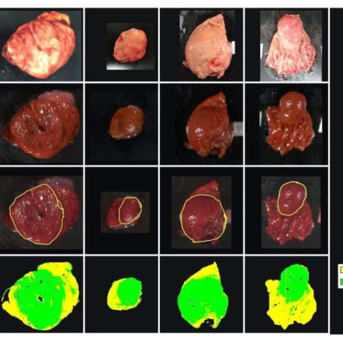 Near-infrared imaging and machine learning can identify hidden tumors