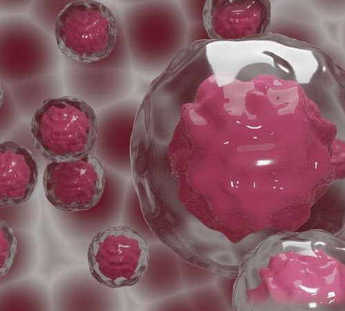 Removing microRNAs from triple-negative breast cancer cells can reverse its spread