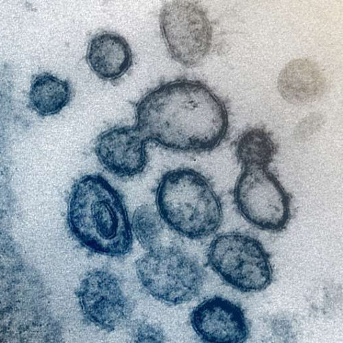 New AI tool can thwart coronavirus mutations