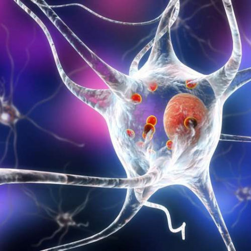 Function identified of ‘mystery protein’ that kills brain cells of people with Parkinson’s