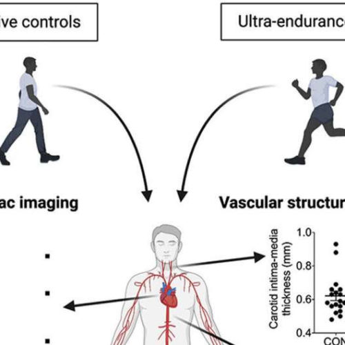 Is too much cardio bad for you? Study says probably not