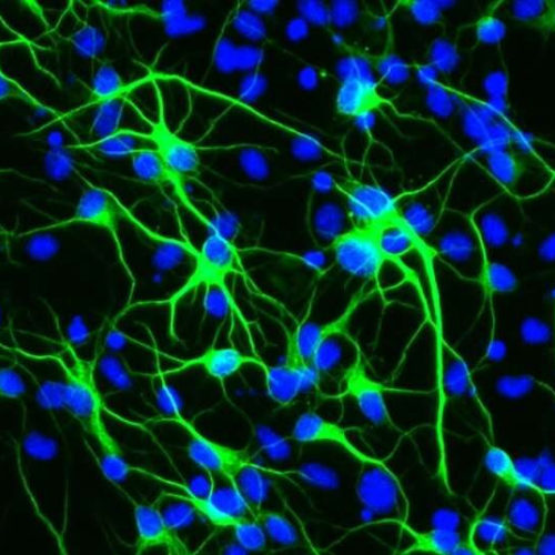 Study reveals how a longevity gene protects brain stem cells from stress