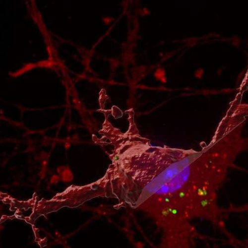 New discovery for how the brain ‘tangles’ in Alzheimer’s disease