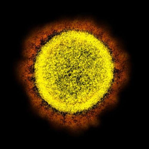 Antibodies to common cold coronaviruses do not protect against SARS-CoV-2