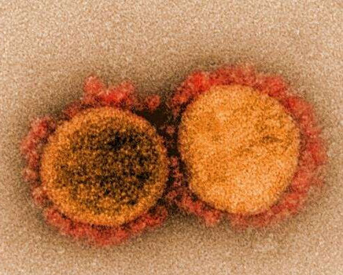 Scientists uncover four new facts about early SARS-CoV-2 infections