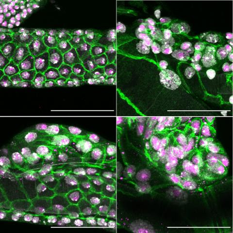 Known tumour suppressor gene found essential for development, regeneration & stress-response