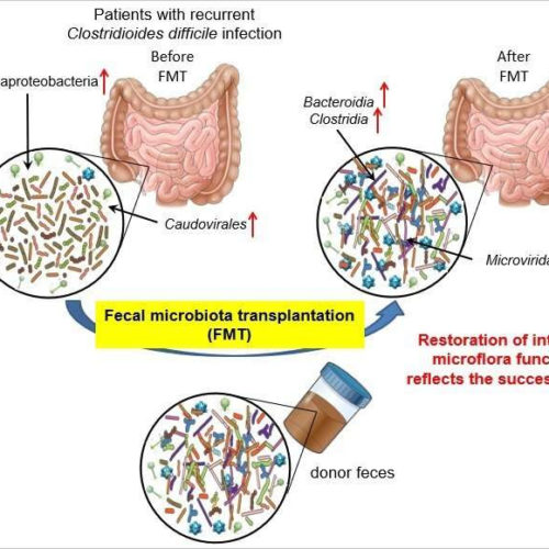 Scientists reveal mechanism behind fecal microbiota transplantation