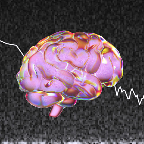 Brain’s ‘Background Noise’ May Hold Clues to Persistent Mysteries