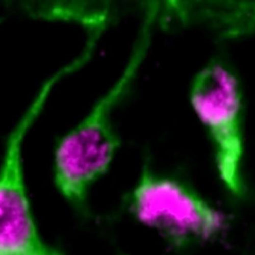 Brain enzyme found to activate dormant neural stem cells, providing insight into neurodevelopmental disorders