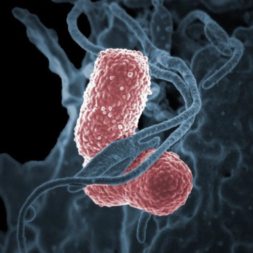 Mouse study shows bacteriophage therapy could fight drug-resistant Klebsiella pneumoniae