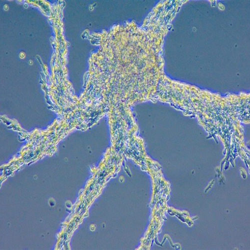 Starvation turns slime moulds into multicellular organisms