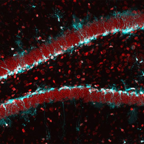 Reactivating aging stem cells in the brain