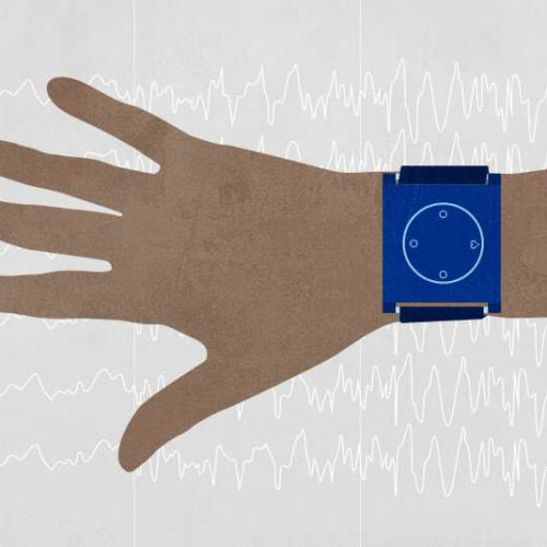 Predicting pediatric seizures with a wristband