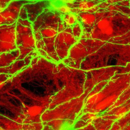 How neural circuits achieve a balance between excitation and inhibition