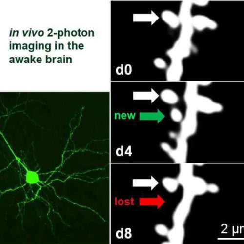 Watching the brain learn