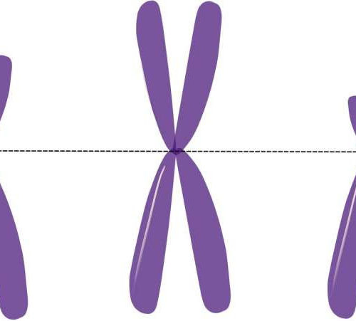 Antisense oligonucleotides as a feasible therapy to treat MECP2 duplication syndrome