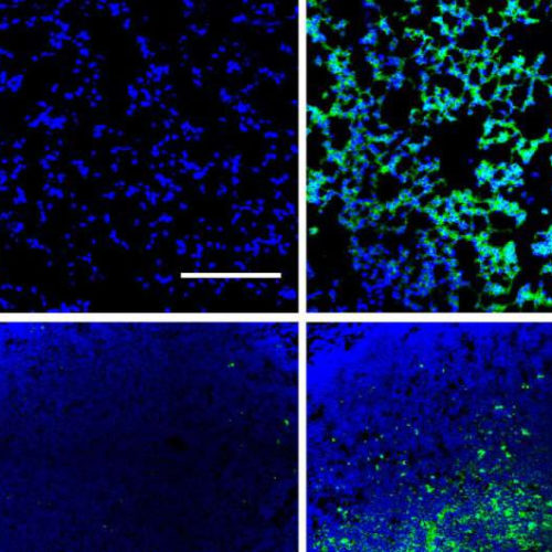 Delivering vaccines directly to the lungs can boost immune responses to respiratory infections or lung cancer: study