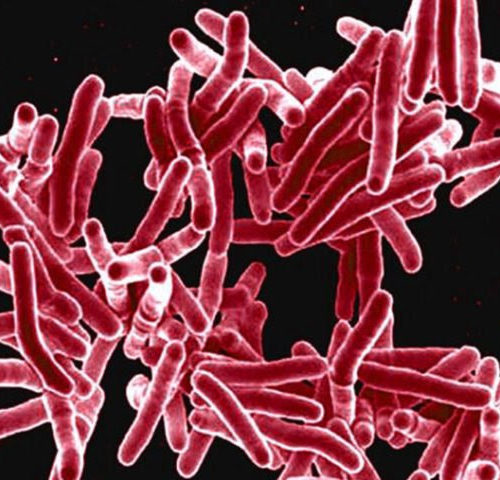 An old antibiotic may combat drug-resistant tuberculosis