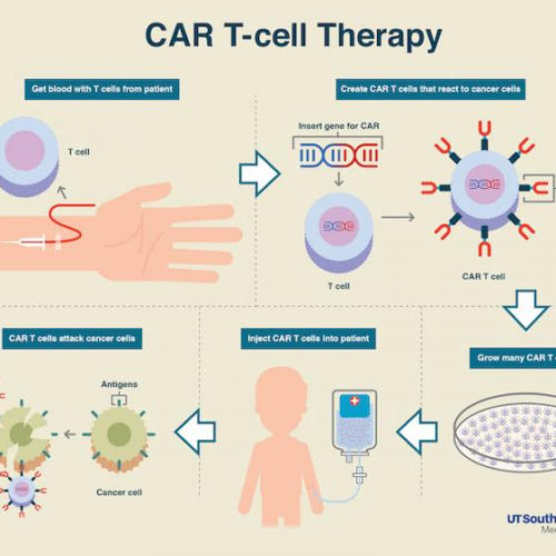 New CAR T-Cell therapy extends remission in heavily relapsed multiple myeloma patients