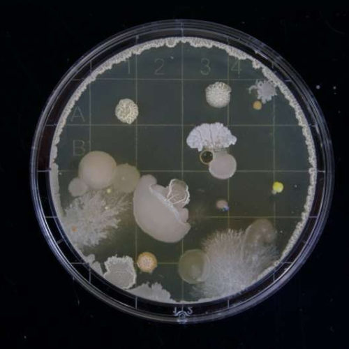 Exposure to superbacteria among visitors to the tropics more extensive than previously thought