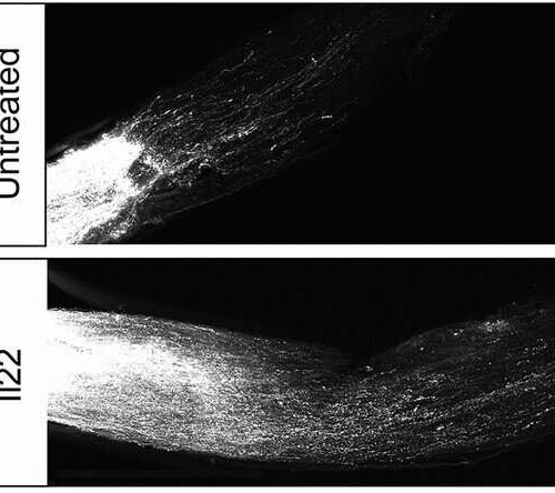 Researchers find dozens of genes that block regeneration of neurons