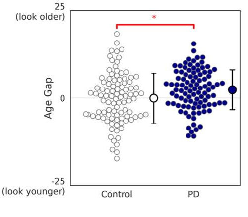 At face value: Using facial analysis algorithm to track changes due to Parkinson’s disease