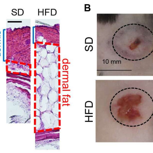 Research identifies obesity and infection link, as well as treatment found on healthy human skin