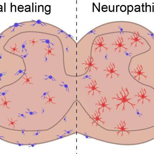 Scientists find new cell type implicated in chronic pain, inflammation