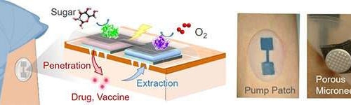 Biobattery-powered microneedle patch can deliver drugs and procure testing samples